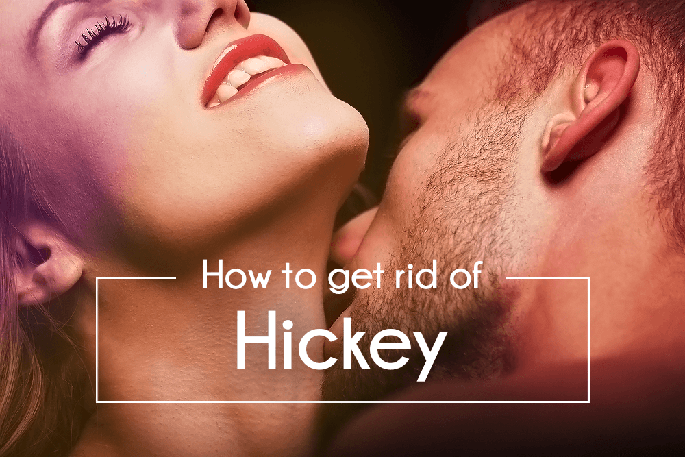 How to Get Rid of Hickey Fast | Get Rid of Love Bites